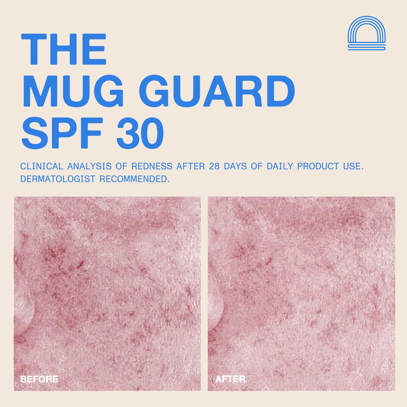 Dune The Mug Guard SPF 30 (Face)