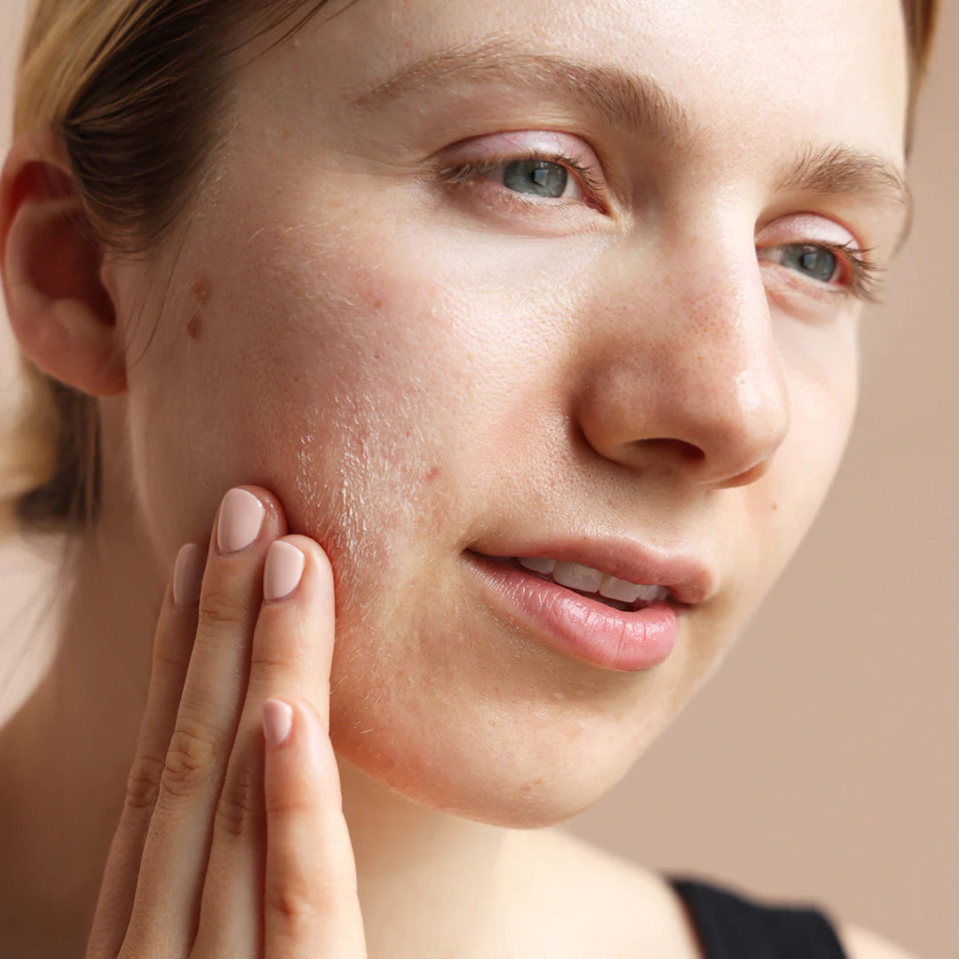 Bioelements Pore Thing Cleanser