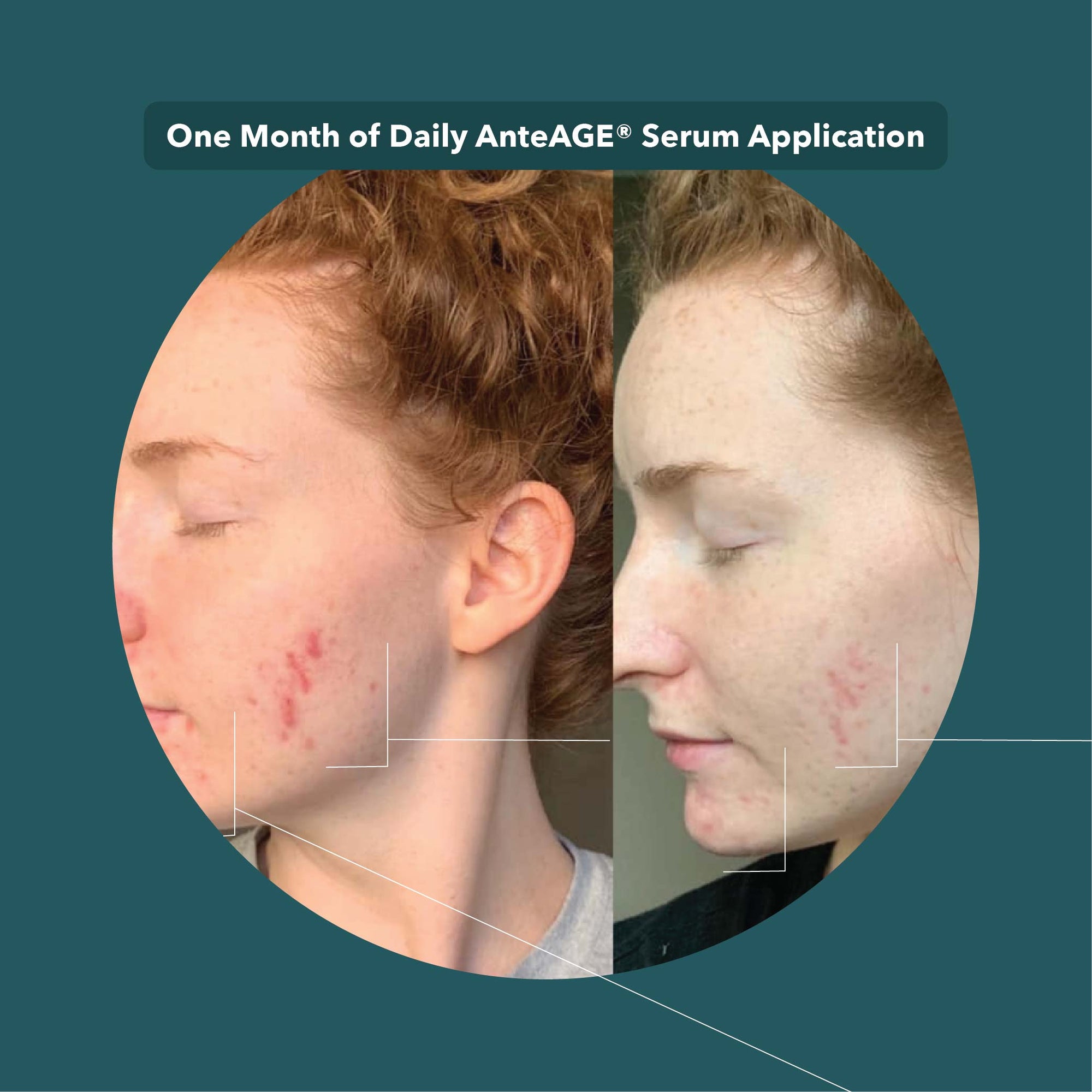 AnteAGE® Growth Factor Serum