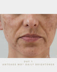 AnteAGE MD® Biosome™ Brightener