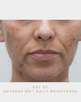 AnteAGE MD® Biosome™ Brightener