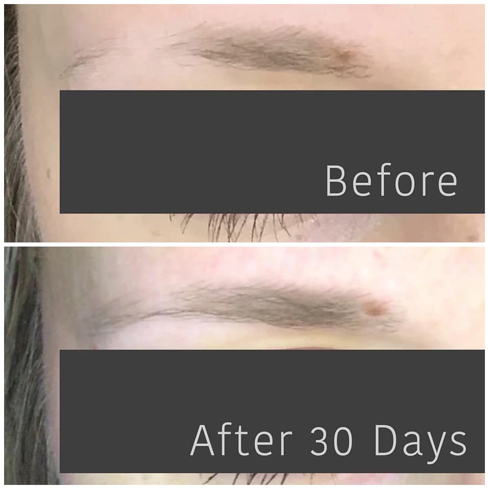 AnteAGE® Overnight Brows Growth Serum - Click to Buy!