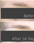 AnteAGE® Overnight Brows Growth Serum - Click to Buy!